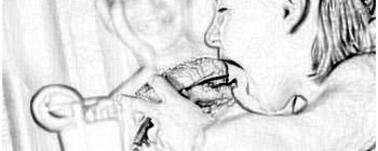 Восемь предикторов кровотечения из верхних отделов желудочно-кишечного тракта после сердечного приступа