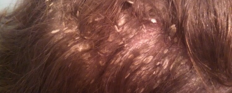 Метод химиотерапии использует собственные клетки пациента как троянского коня, направляющего противораковые препараты в опухоли.