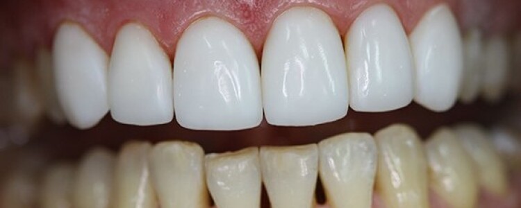 Выгодно ли регенерировать электродвигатели?