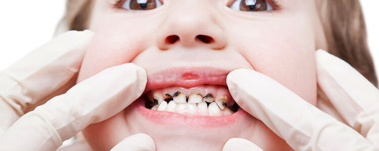 Диета для диабетиков