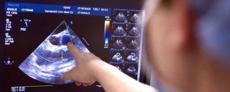 Созависимость белков клеточного ядра — ключ к пониманию жировой болезни печени