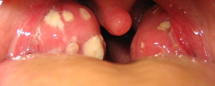 Измерение воздействия загрязнения воздуха в домах в странах Африки к югу от Сахары