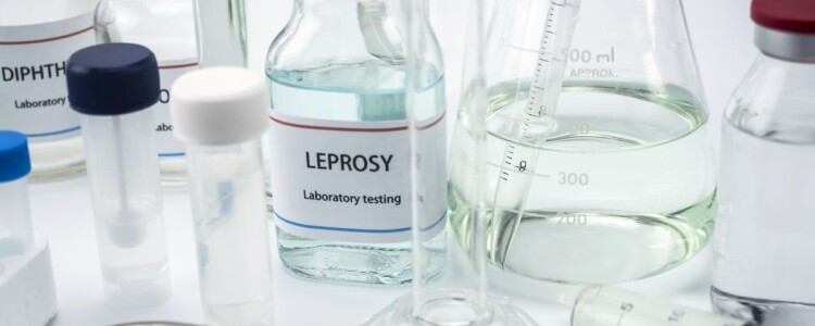 Рекомендации для выбора качественного ортопедического матраса на кровать