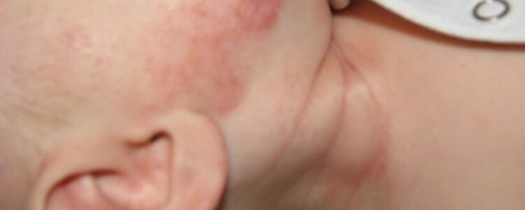 Первичная роль сна меняется от поддержки обучения к поддержке мозга в раннем детстве: исследование