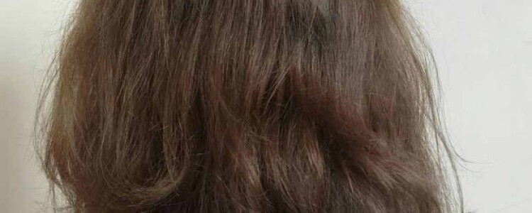 Что такое поясничный сколиоз позвоночника