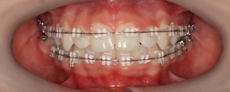 Смарт-браслеты Xiaomi: оптимальный выбор для активного и здорового образа жизни