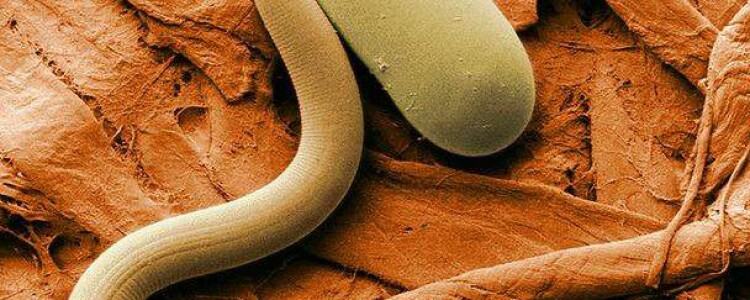 Реальные результаты использования нового устройства для лечения аневризм головного мозга