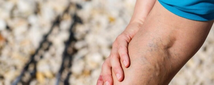 Согласно исследованию Penn Medicine, работа с высокой активностью связана с экстремальным сном