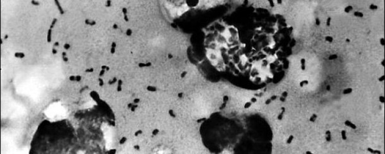 Новый центр геномики нейродегенерации Пенна создает национальный центр исследований болезни Альцгеймера