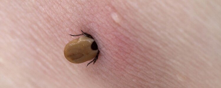 Препарат гепотидацина для лечения инфекций мочевыводящих путей показал хорошие результаты в клинических испытаниях по сравнению с нитрофурантоином.