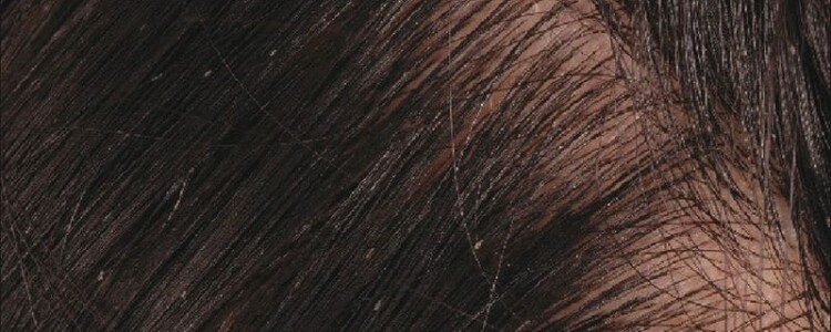 Аденома простаты