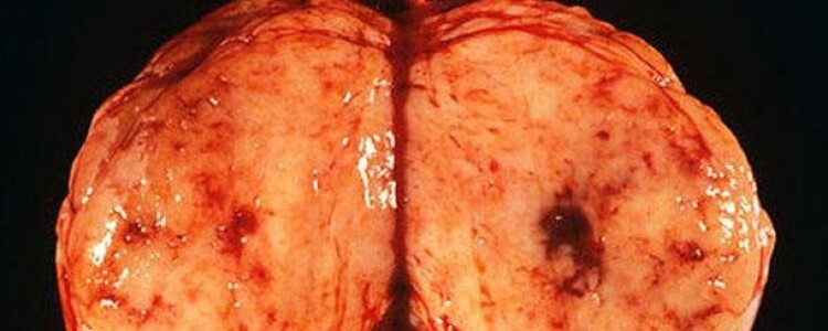 Распродажа: узнайте основные правила, которые сделают вашу покупку дешевле!