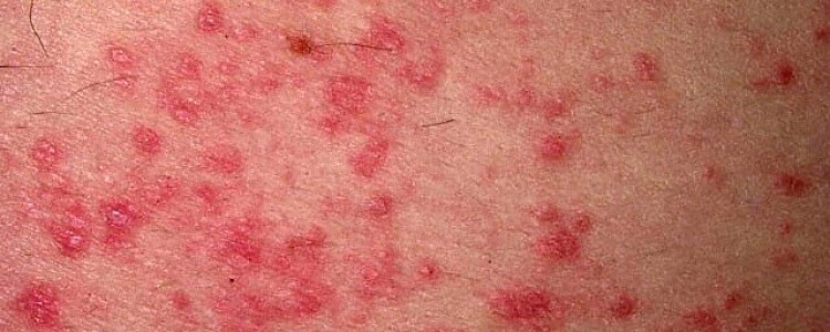 Виды пластиковых мусорных баков