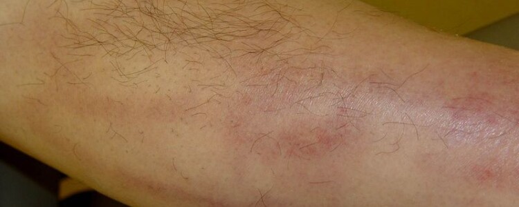 Вся правда о халатах