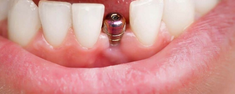 Преимущества услуги выкупа автомобилей: Как это работает и что вы выигрываете