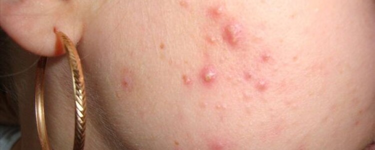 Обзор делится «современными» знаниями о грибковых заболеваниях