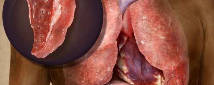 Мобильное устройство для проведения УЗ диагностики: инновация, меняющая подход к медицине