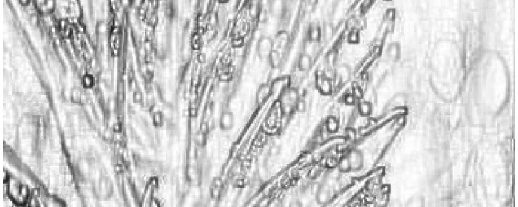 Ощущение в первые дни беременности