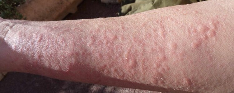 Как не поссориться с родственниками во время беременности