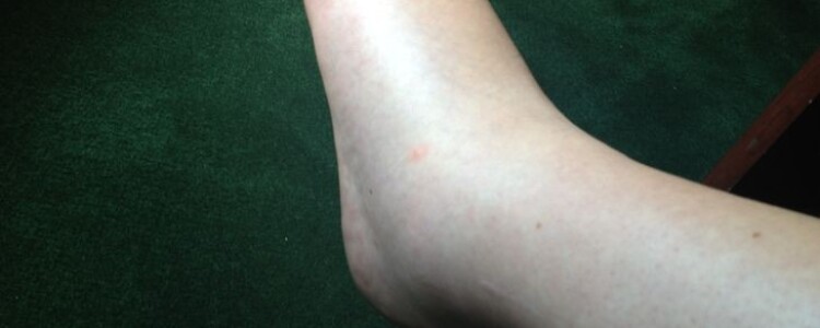 Новая цель может помочь защитить кости с возрастом