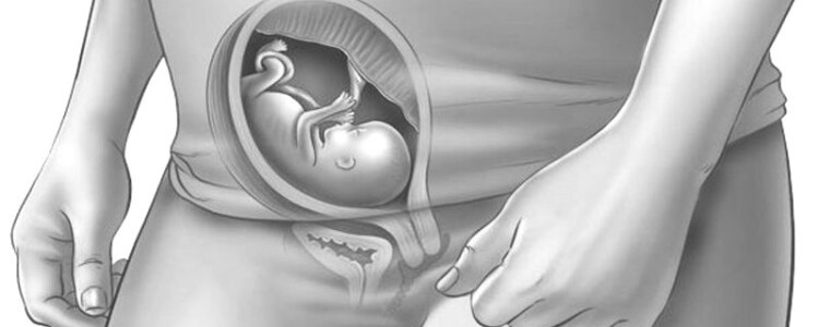 Исследование показало, что высокий уровень фактора роста увеличивает риск нескольких видов рака.