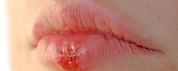 Ген, отвечающий за обоняние, может играть роль в распространении рака молочной железы в мозг