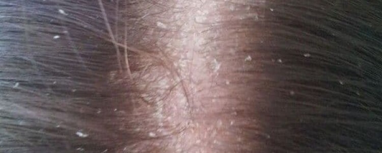 Преимущества Поверки Счетчиков Воды: Экономия и Точность