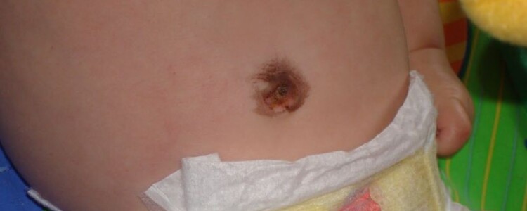 Исследователи обнаружили связь между опухолями головного мозга человека и собак