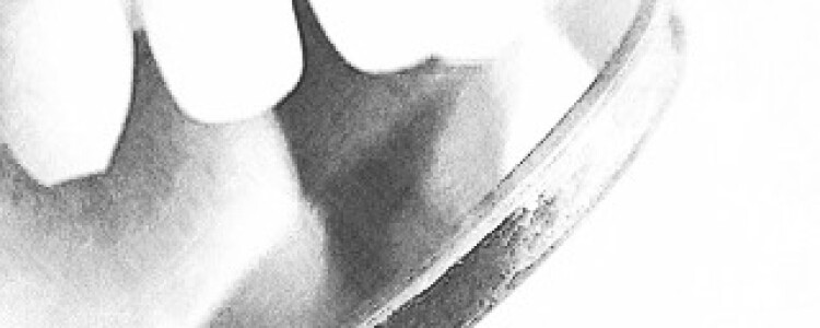 Как лечить пиелонефрит в домашних условиях