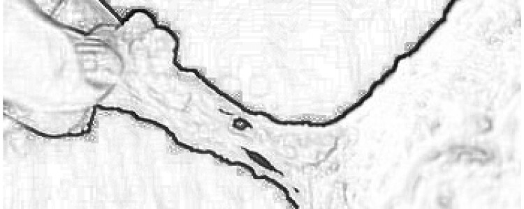 Выбор поставщика медицинского оборудования
