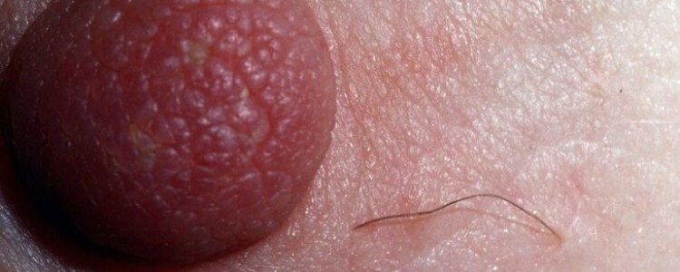 Молодые мыши, которым переливали кровь старых мышей, быстрее утомлялись и бегали на более короткие дистанции.