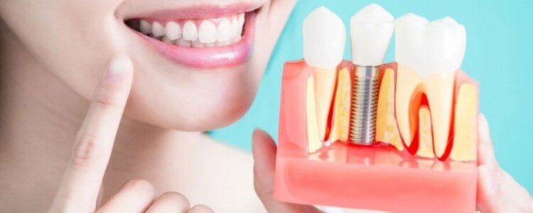 Протезирование Зубов: Восстановление Улыбки и Полноценной Жизни