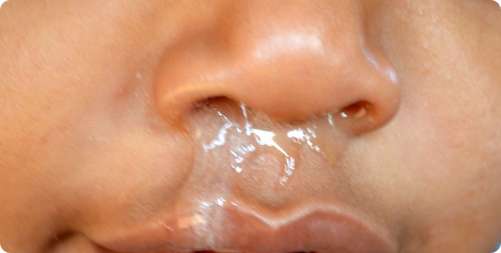 Как лечить насморк