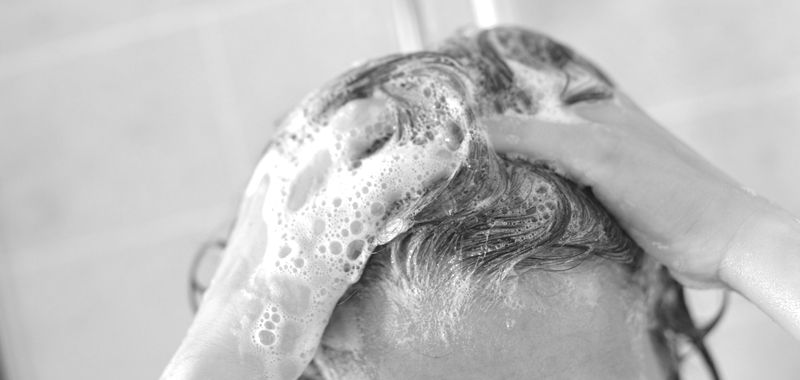 перхоть фото